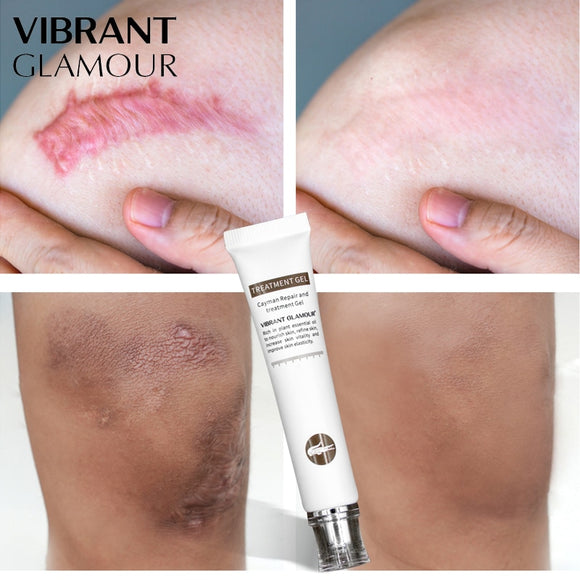 VIBRANT GLAMOUR  Non-Surgical Scar Removal Cream